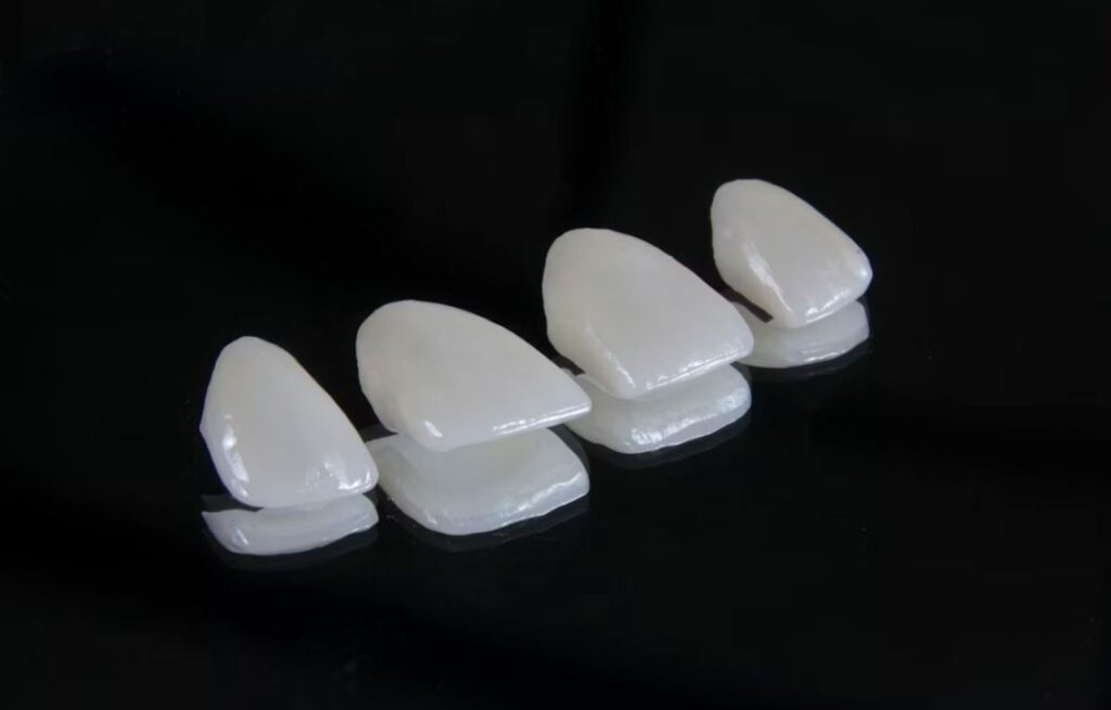 вигляд вінірів